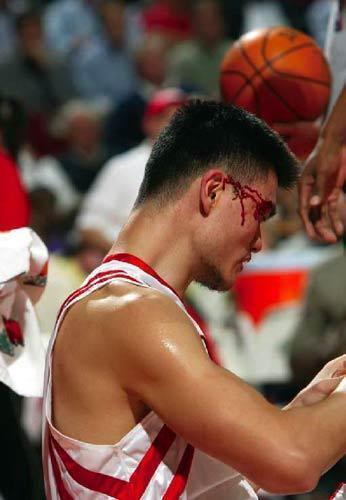 姚明受傷組圖回顧:骨折最為嚴重 下巴流血難止-體育